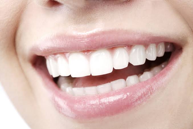 Teeth Whitening greater noida, dental crown noida, RCT Treatment in noida, dental assistant ghaziabad, periodontist delhi ncr, segen clinic, dr neetika, segen clinic