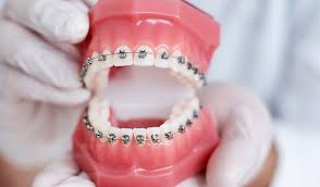 Best and Reliable Endodontist noida, Best and Reliable Facial Peels greater noida, Best and Reliable Dental Implants ghaziabad, Best and Reliable Teeth Cleaning noida, dr neetika, segen clinic
